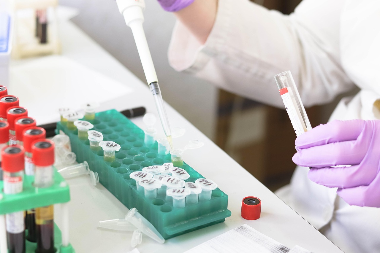 流感患者安置，全面、科学、人性化的医疗管理策略流感患者安置